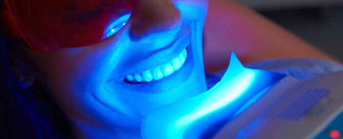 Teeth Whitening: Professional vs. At-Home Methods