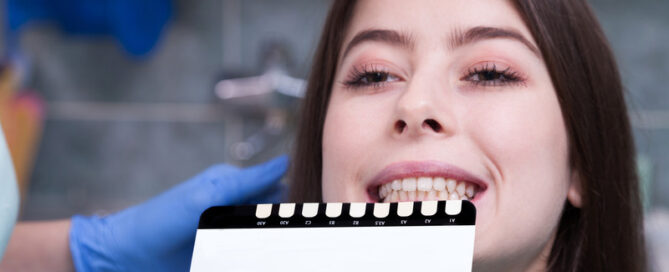 Can You Whiten Veneers, Crowns, or Bonding?