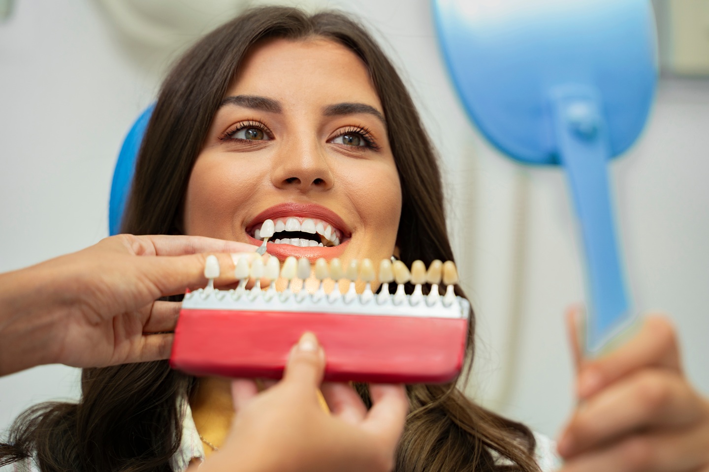 Your Complete Guide to the Veneer Procedure
